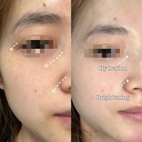 Crème éclaircissante à 5% de niacinamide, crème blanchissante à la nicotinamide, soin lissant de la peau, crème hydratante de nuit pour le visage