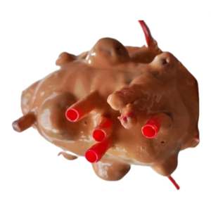 Módulo de modelo de entrenamiento de miomectomía de tumor de endoscopia quirúrgica KyrenMed para práctica - Product Image 1