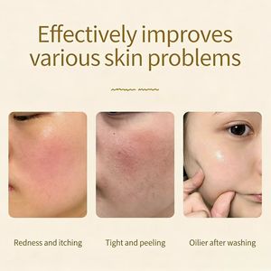 Jabón Facial <span class=keywords><strong>y</strong></span> Corporal de Marca Privada NATTH, Jabón para el Cuidado de la Piel, Blanqueador, Antiacné, Orgánico, Hecho a Mano con Leche de Cabra, <span class=keywords><strong>Avena</strong></span> <span class=keywords><strong>y</strong></span> <span class=keywords><strong>Miel</strong></span>, 140 g, Sólido - Product Image 5