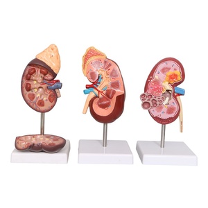 Modelo de anatomía renal ampliado, glándulas suprarrenales, riñón enfermo, modelo anatómico de órgano interno humano para escuelas de ciencias médicas - Product Image 1