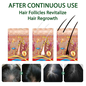 EELHOE <span class=keywords><strong>Spray</strong></span> instantané pour <span class=keywords><strong>racines</strong></span> permanentes, <span class=keywords><strong>spray</strong></span> colorant pour <span class=keywords><strong>cheveux</strong></span> <span class=keywords><strong>blancs</strong></span>, <span class=keywords><strong>spray</strong></span> éclaircissant pour <span class=keywords><strong>cheveux</strong></span>, <span class=keywords><strong>spray</strong></span> lissant et épaississant pour <span class=keywords><strong>cheveux</strong></span>, marque privée - Product Image 6