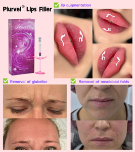 Produits Plurvel Fine Lips, <span class=keywords><strong>acide</strong></span> <span class=keywords><strong>hyaluronique</strong></span> en profondeur, produit de comblement dermique pour l'augmentation des lèvres et le lifting du visage, <span class=keywords><strong>injection</strong></span> de comblement pour les joues - Product Image 3