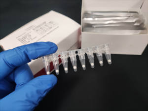 Kit de détection moléculaire de la fièvre <span class=keywords><strong>typhoïde</strong></span> et paratyphoïde, usage recherche uniquement (RUO) - Product Image 3