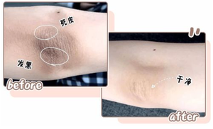 Peeling-Öl für Knöchel Serum Flüssigkeit Strong White ning Body Serum Öl Starkes Peeling-Öl - Product Image 3