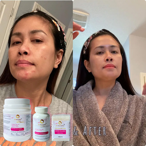 Oem אורגני קולגן חלבון אבקת דגים עור העור הים קולגן פפטיד ויטמין c סבון קפסולות מבוגרים פונקציה אנטי אייג 'ינג - Product Image 4