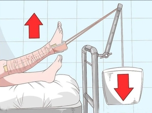 Kit traksi kulit perekat sekali pakai kualitas tinggi terlaris untuk perawatan luka - Product Image 6