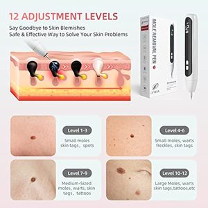 Youmay xách tay da TAG Remover bút cho nốt ruồi, mụn cóc và da Tag cho phụ nữ và trẻ em gái ophera - Product Image 4