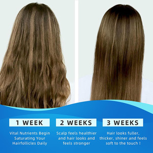 Gomitas Blanqueadoras de Colágeno Múltiple OEM/ODM, Favorecen la Salud del Cabello, la Piel y las Uñas, Gomitas de Péptidos de Colágeno Múltiple - Product Image 6