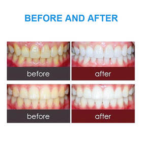 Lampu kilat fotografi gigi, lampu kilat fotografi ponsel dengan braket - Product Image 5