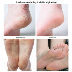 Aromathérapie — produits de pédicure pour femmes, Massage au Spa, huile d'arbre à thé, tremper les pieds - Product Image 6