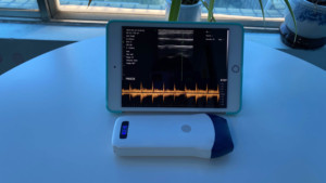 Machine à ultrasons en sitérite linéaire sans fil, échographie vasculaire en sitérite linéaire portative, 128 éléments - Product Image 4