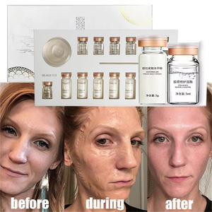 ZS masker enzim pengencang pengangkat wajah Korea, masker enzim penglupas enzim mengencangkan wajah - Product Image 1