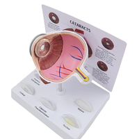 Modèle oculaire pathologique avec lentilles interchangeables pour la démonstration de la cataracte