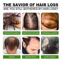 Traitement avancé de la croissance des cheveux Toniques de repousse des cheveux à cellules souches EGF avec peptides Renforcer le kit de soin du cuir chevelu de réparation des follicules radiculaires