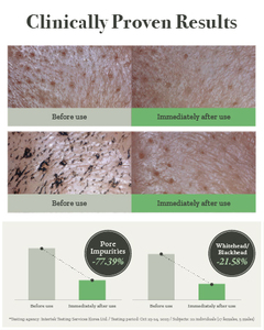 Mascarilla facial de barro calmante y arcilla <span class=keywords><strong>para</strong></span> el cuidado de los poros de tomate verde natural - Product Image 5