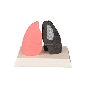Modelo <span class=keywords><strong>de</strong></span> pulmón <span class=keywords><strong>de</strong></span> <span class=keywords><strong>fumador</strong></span> <span class=keywords><strong>de</strong></span> silicona <span class=keywords><strong>de</strong></span> tamaño pequeño para demostración <span class=keywords><strong>de</strong></span> pulmón saludable educativo - Product Image 1
