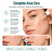 Sérum à l'acide azélaïque 10% BEIKE OEM, acide hyaluronique, niacinamide, apaise les rougeurs, équilibre le sébum, éclaircit la peau, sérum pour le visage