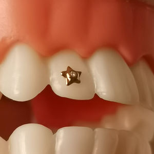 Grillz dentaire en or 8K en forme d'étoile avec zircone, bijoux dentaires personnalisés, style Bling Hip Hop - Product Image 4