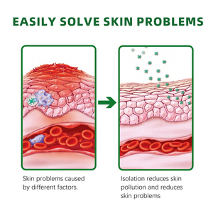 SmmlpunHerbal King Crema para picazón <span class=keywords><strong>tiña</strong></span> hidratante toxina pomada antibacteriana externa venta al por mayor cuidado de la piel del pie - Product Image 5