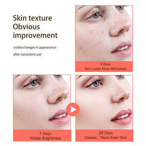 Sérum Iluminador de Vitamina C al por Mayor OEM/ODM con Vitamina E, Ideal para la Pérdida de Colágeno, Tono Desigual y Manchas Oscuras - Product Image 3