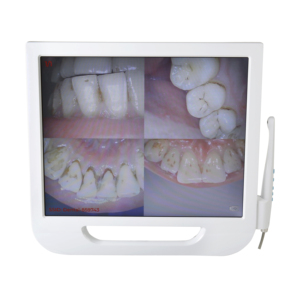 Système de caméra intra-orale haute résolution de la marque TOYE, objectif <span class=keywords><strong>macro</strong></span>, caméra orale pour usage <span class=keywords><strong>dentaire</strong></span> avec moniteur PC - Product Image 3