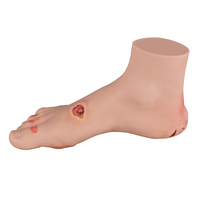 Modelo de Úlcera del Pie Diabético Pro-Health, Etapas Leves y Severas, Material de Silicona, Modelo Anatómico Educativo para Entrenamiento Médico Hospitalario