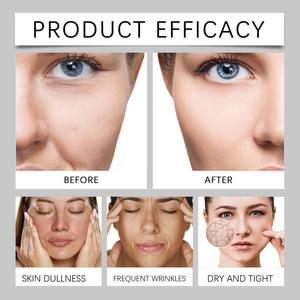 Venta caliente Mejora el tono de la piel hidrata y restaura el resplandor 50g veneno de abeja crema facial brillante - Product Image 5