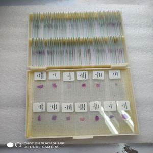 Factory direct supply of biological slides for medical histology, regeneration, <strong>aplastic</strong> anemia, and bone marrow smears. - Product Image 2