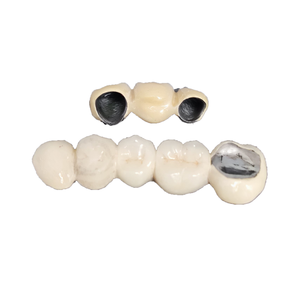 1 KG <span class=keywords><strong>Prix</strong></span> d'usine Alliage <span class=keywords><strong>dentaire</strong></span> PFM Nickel-Chrome pour la fabrication de prothèses dentaires en <span class=keywords><strong>porcelaine</strong></span>, restauration de couronnes métalliques - Product Image 4