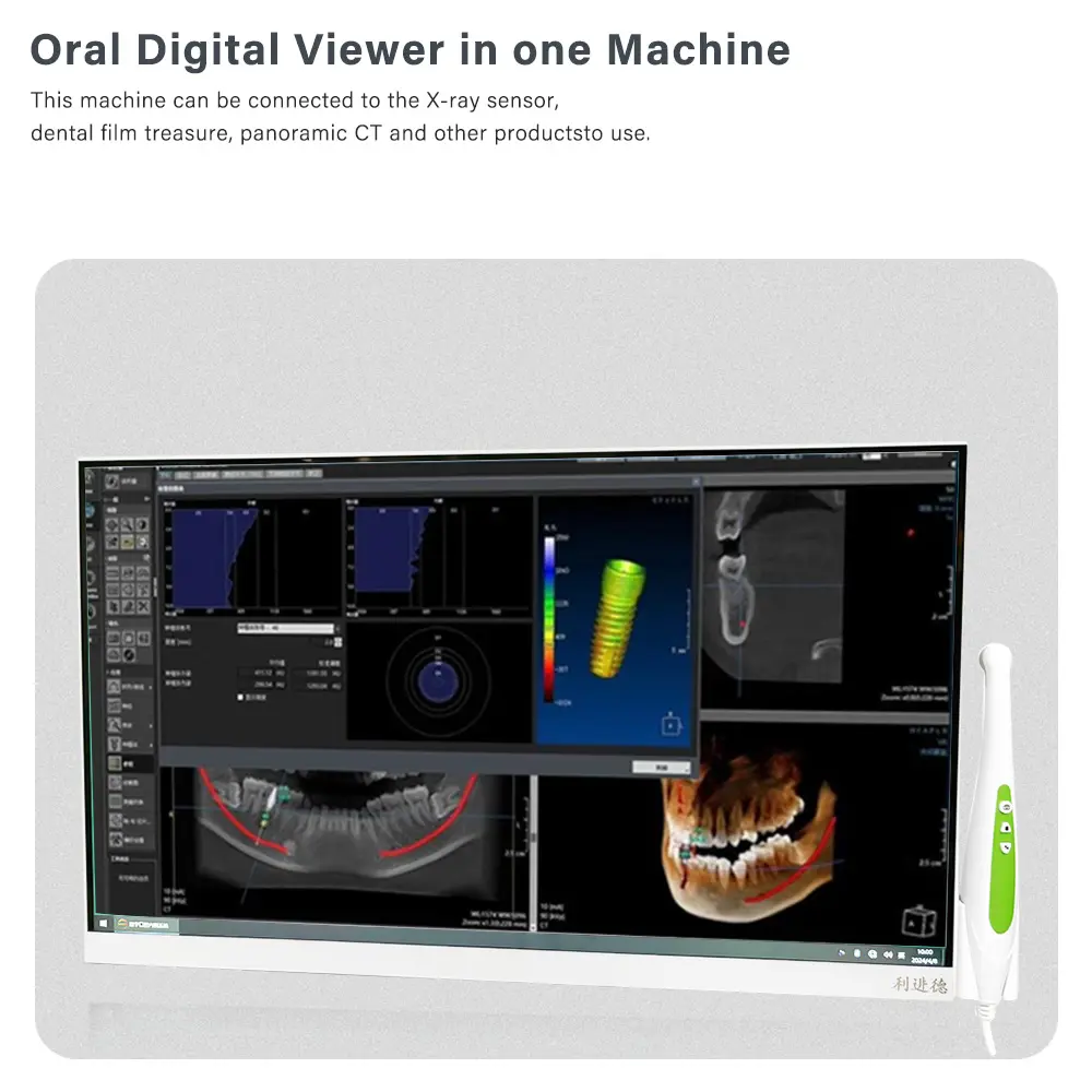 Câmera intraoral dental com monitor de 24 polegadas com tela de toque para janelas 10