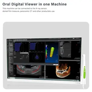 24 pulgadas pantalla táctil Windows 10 cámara intraoral dental con monitor