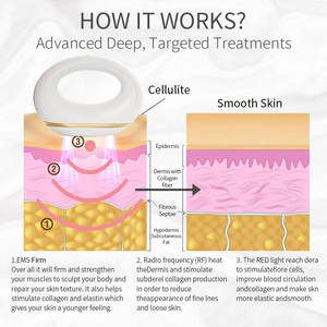 Máquina de eliminación de celulitis antienvejecimiento EMS de belleza para el hogar eficaz, dispositivo para quemar grasa, masajeador corporal para Estiramiento facial magro, hierro para quemar grasa - Product Image 6