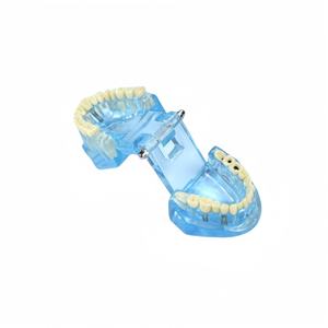 Protesi dentale, plastico dentale modello denti, restauro con impianto - Product Image 6