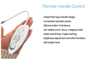 Colposcopie optique gynécologique, colposcopie optique gynécologique, colposcope vidéo numérique pour gynécologie - Product Image 6