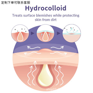 Apósitos hidrocoloides médicos transfronterizos, parches de piel artificial para el acné, hidrogel de color invisible a prueba de sudor para marcas de acné. - Product Image 4