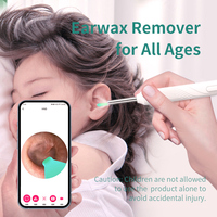 Curette auriculaire visuelle sans fil, outil professionnel intelligent d'endoscopie auriculaire haute définition, curette auriculaire, outil de nettoyage des oreilles
