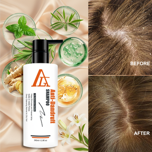 Champú Anticaspa Nutritivo para el Cuero Cabelludo, Fórmula Antifúngica, Revitaliza los Cuero Cabelludos Secos, Elimina las Escamas y Retiene la Humedad - Product Image 4