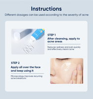 Gel anti-acné réparateur rapide et efficace pour cicatrices d'acné, élimination des taches, lissage de la peau, resserrement des pores, crème pour le visage à l'acide salicylique