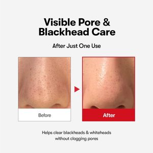 Olio Detergente all'Acido Azelaico, Texture Leggera e Acquosa, Senza Profumo, Struccante per Pelli Sensibili e Acneiche - Product Image 4