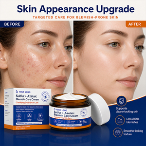 Crème Apaisante Anti-Acné à Base de Plantes ODM pour Peaux à Tendance Acnéique : Apaise les Irritations, Débouche les Pores, Calme les Inflammations et Atténue les Imperfections à l'Acide Azélaïque - Product Image 2