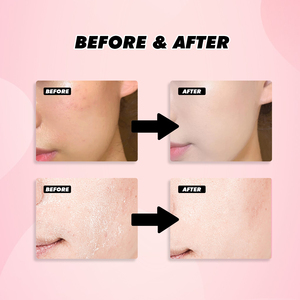 <span class=keywords><strong>Crema</strong></span> <span class=keywords><strong>Facial</strong></span> de Colágeno en Gel, Mayorista, Más Vendida, Fortalece la Barrera Cutánea, Hidrata, con Niacinamida - Product Image 5