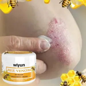 Wiyun 30g bee venom itch pain relieving dryness reducing guttate palmoplantar scalp nail plaque psoriasis treatment cream