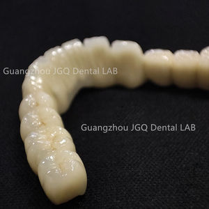 Metallo ceramico dentiere produttore di prodotti dentali Custom Pfm corone ponti con rosa gomma porcellana - Product Image 5