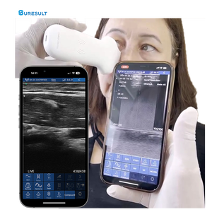 Alat genggam estetis 20MHz wajah, dengan dukungan Doppler warna <span class=keywords><strong>DICOM</strong></span> untuk prosedur estetika Clarius L20 - Product Image 5