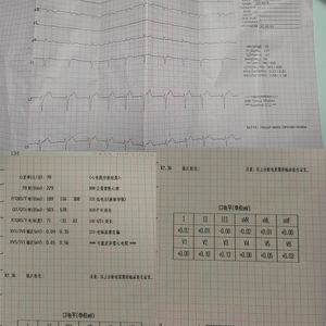 Electrocardiógrafo Digital de 12 Derivaciones, Monitor de ECG Cardíaco con Análisis Automático, Dispositivo de ECG USB para Hospitales y Centros Médicos - Product Image 6