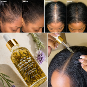 Huile de croissance capillaire à la menthe poivrée, biotine et huile de ricin, marque privée, pour la repousse des cheveux - Product Image 4