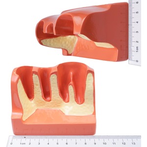 Modèle d'implant dentaire oral avec couronne et pont amovibles, adapté à la démonstration et à la formation des étudiants en dentisterie - Product Image 6