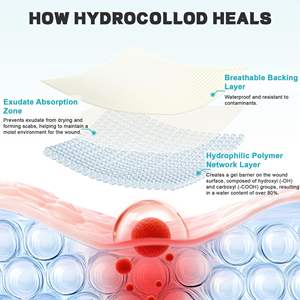 Parches Adhesivos Estériles, Impermeables y Altamente Absorbentes para Úlceras por Presión, Rollo de Hidrocoloide para el Cuidado de Quemaduras, Ampollas, Acné y Espinillas - Product Image 3