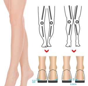 Coussinets de talon orthopédiques correcteurs légers en gel adhésif pour jambes en X et en O, en forme de cale médiale et latérale - Product Image 6