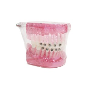 Modèle de démonstration de support semi-métallique et semi-céramique ; outil pédagogique orthodontique comparatif pour la communication médecin-patient. - Product Image 5